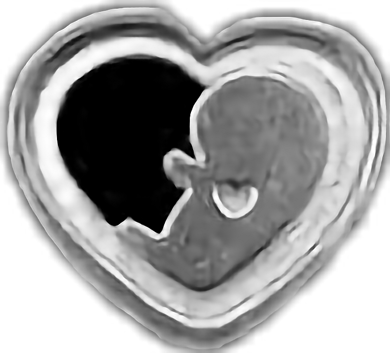 baby babies stillbirth sids stillborn sticker by aleisha